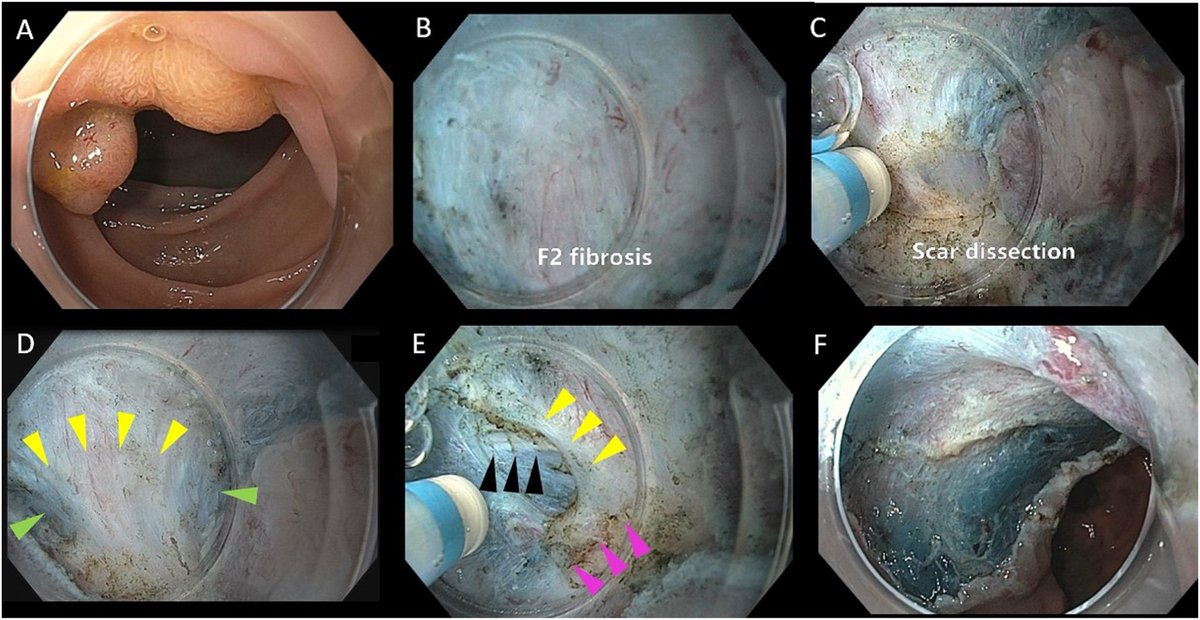 Suchapa Arayakarnkul, MD tweet media