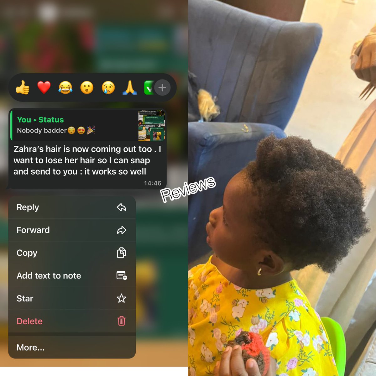 Struggling with hair loss or slow growth? 😩
Say hello to Kiwal’s Ayurvedic Haircare Kit 🌿
Made with powerful natural herbs it nourishes, strengthens, and transforms your hair from roots to tips! ✨
💰 Kits start from ₦9,500
📍 Lagos
🚚 Nationwide Delivery
RT 🙏