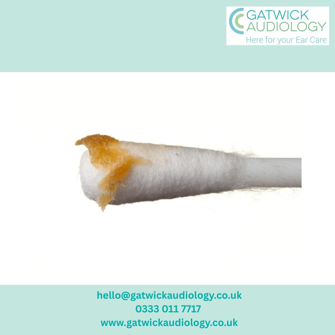 Your earwax says more than you think!
 🟡 Yellow = normal
 🔴 Red = irritation/bleeding
 🟢 Green = infection
 ⚫ Black = fungal/old wax

Noticing sudden changes? Time to see a pro.
Read more//bit.ly/41KIi9B  
#GatwickAudiology #microsuction #earwaxremoval
<a href="/twitter/">Twitter</a>