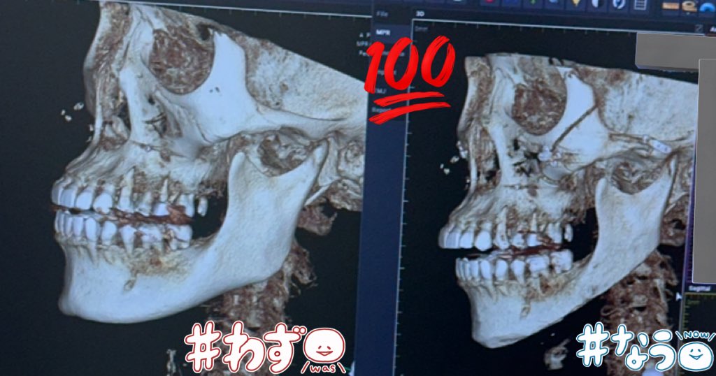 ｱｼﾒｺﾞﾘﾗちゃん🦍🎽🦪💚 tweet media