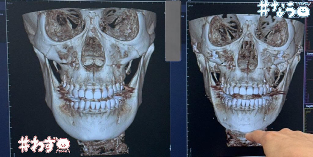 ｱｼﾒｺﾞﾘﾗちゃん🦍🎽🦪💚 tweet media