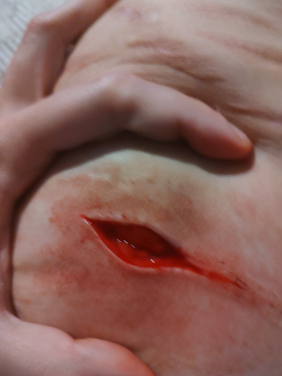 agoogogaga's tweet photo. Thought I'd like cutting on my thigh again but this looks so pathetically small :/#bloodtwt #redinktwt #styrotwt #raspberryfilling #ouchietwt #shtwt #sh #selfharm https://t.co/KHkgeP6gU1
