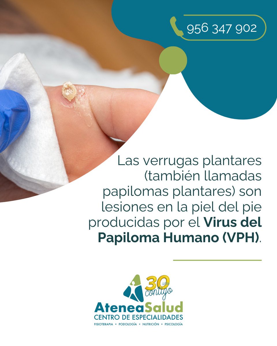 👉Son lesiones en la piel del pie producidas por el Virus del Papiloma Humano (VPH).

👉Se diferencian de los callos porque suelen ser dolorosas al presionarlas de forma directa o lateral y tienen puntitos negros en el centro. 

📞 956 347 902 | 🌐 ateneasaludjerez.com