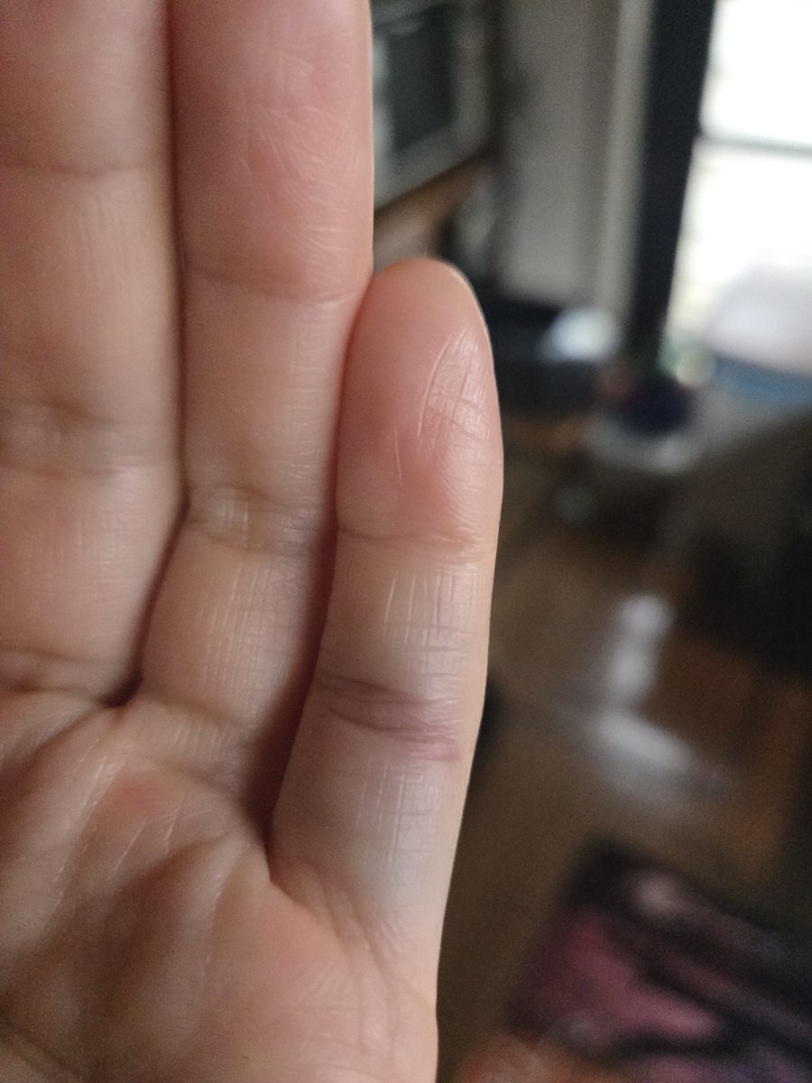 写メだとあんまりわかんないけど、

仕事で小指をなんかやらかしちゃったったぽい😇
