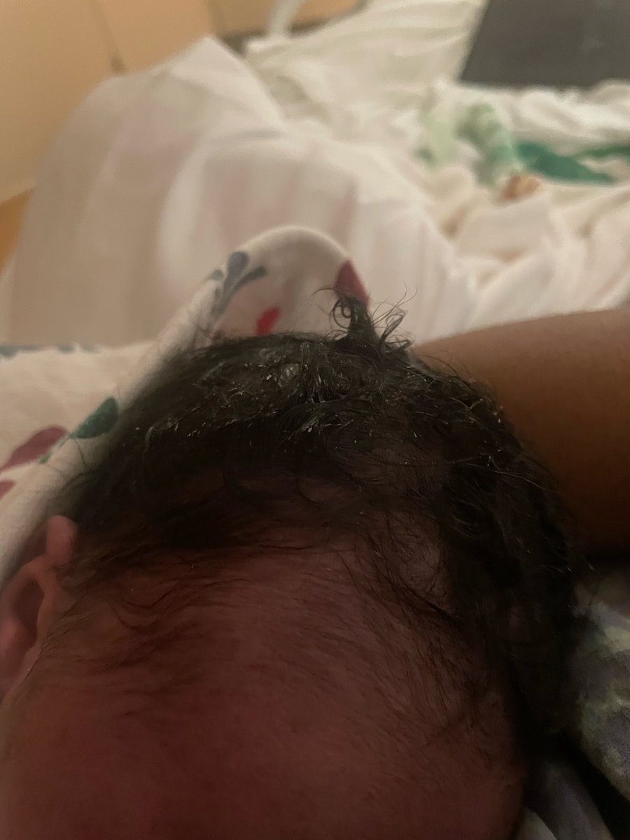 so thankful for no bald baby🥹