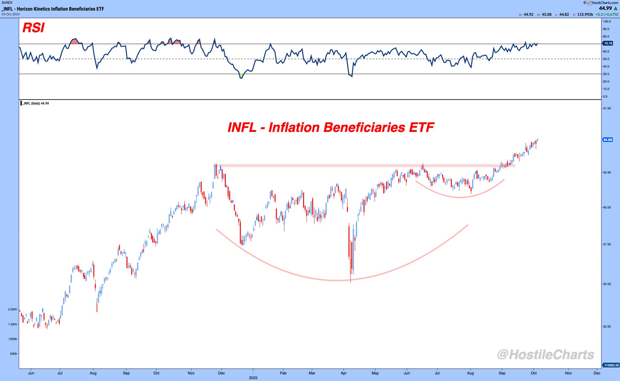 洋書 Chronic Inflation 洋書 Chronic Inflation 5c709717-a65d-47ad-8c16-