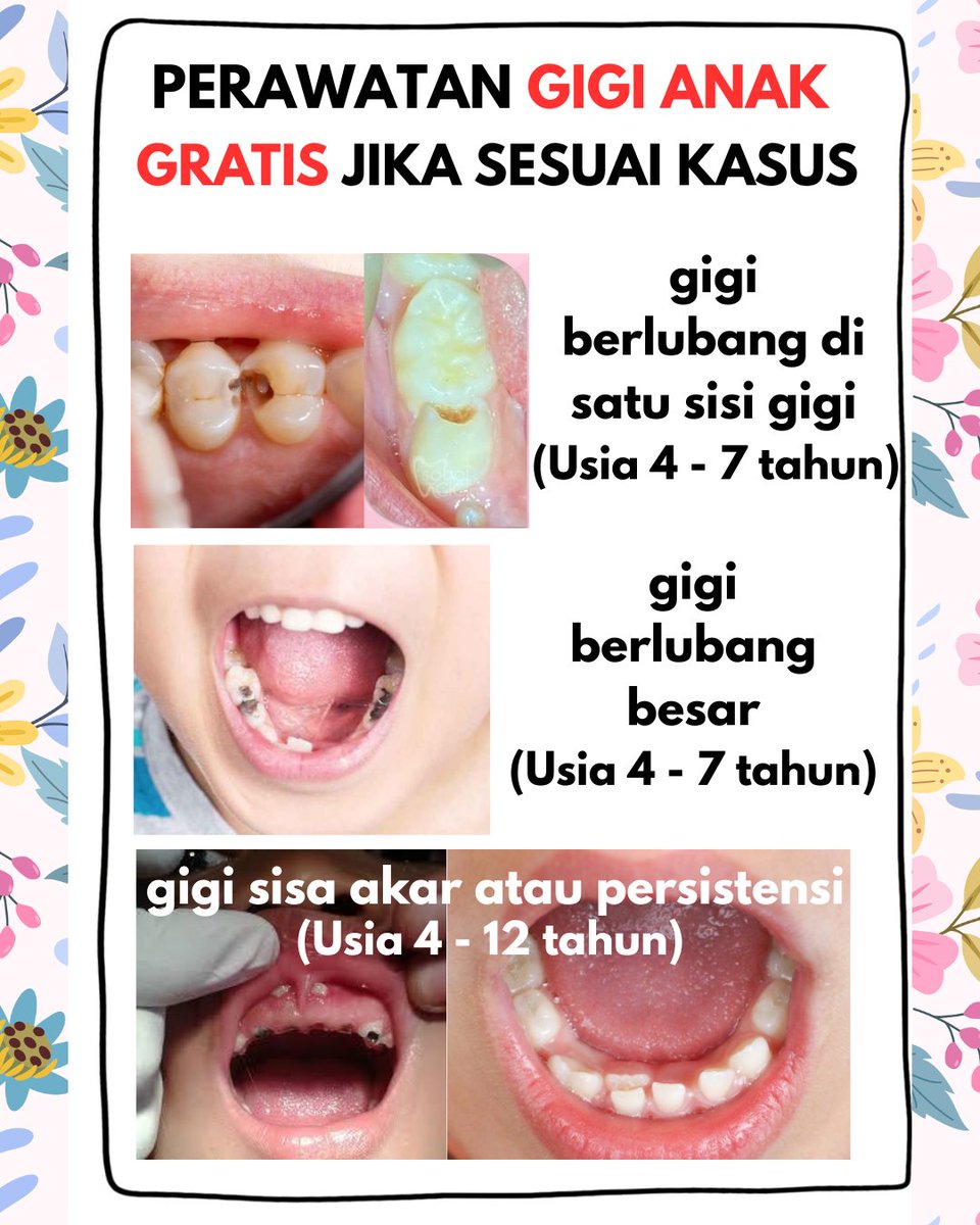 usetisi's tweet photo. malam semua aku dokter gigi muda di bintaro, jakarta selatan sdg mencari pasien gigi seperti gambar
-Perawatan di weekday (senin-jumat)
-Disupervisi Dokter Spesialis
-Bersedia datang lebih dari 1x
#koas #fkg #koasgigi #coass #coassfkg #kedokterangigi zonauang zonajajan zonaba https://t.co/zaT627WUGb