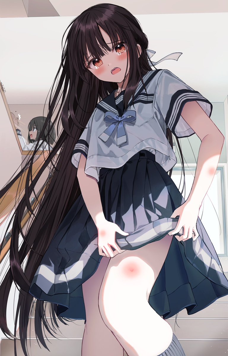 ねえ見て〜ちょっと外に出ただけでやられた…」」|ぺんた