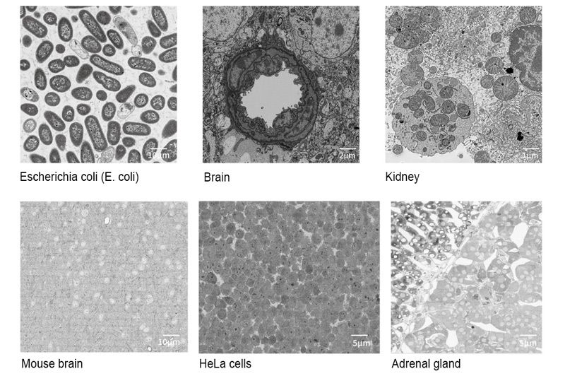 ciqtek's tweet image. 🔬 #CIQTEK Launches VEM Solution
Integrating SS-SEM, SBF-SEM, and FIB-SEM for high-speed, high-res 3D biological reconstruction with AI.
🔗 Learn More: buff.ly/amM3neI
#3DReconstruction #ElectronMicroscopy #LifeSciences #SEM