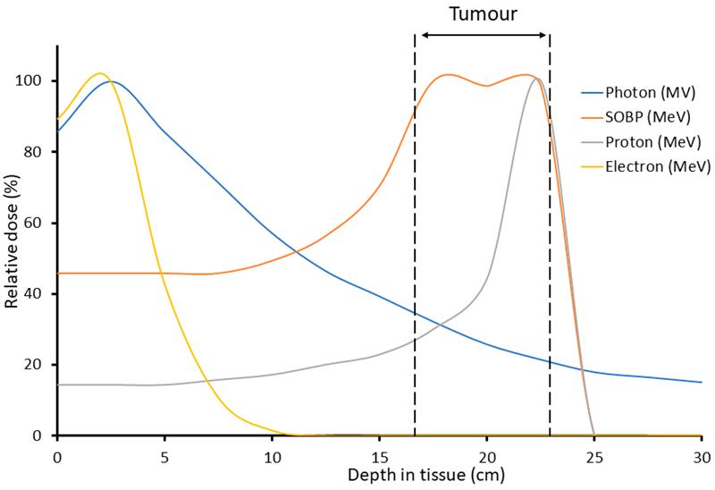 IJMS_MDPI's tweet photo. ✨#MostViewedPaper
📖FLASH Radiotherapy: Current Knowledge and Future Insights Using Proton-Beam Therapy
🧑🔬By Dr. Jonathan R. Hughes and Dr. Jason L. Parsons
🔗Read more: https://t.co/iyDggJIbAJ
#OpenAccess #MDPIIJMS #FLASH #ProtonBeamTherapy #Radiotherapy https://t.co/Rc0GzSWVuC