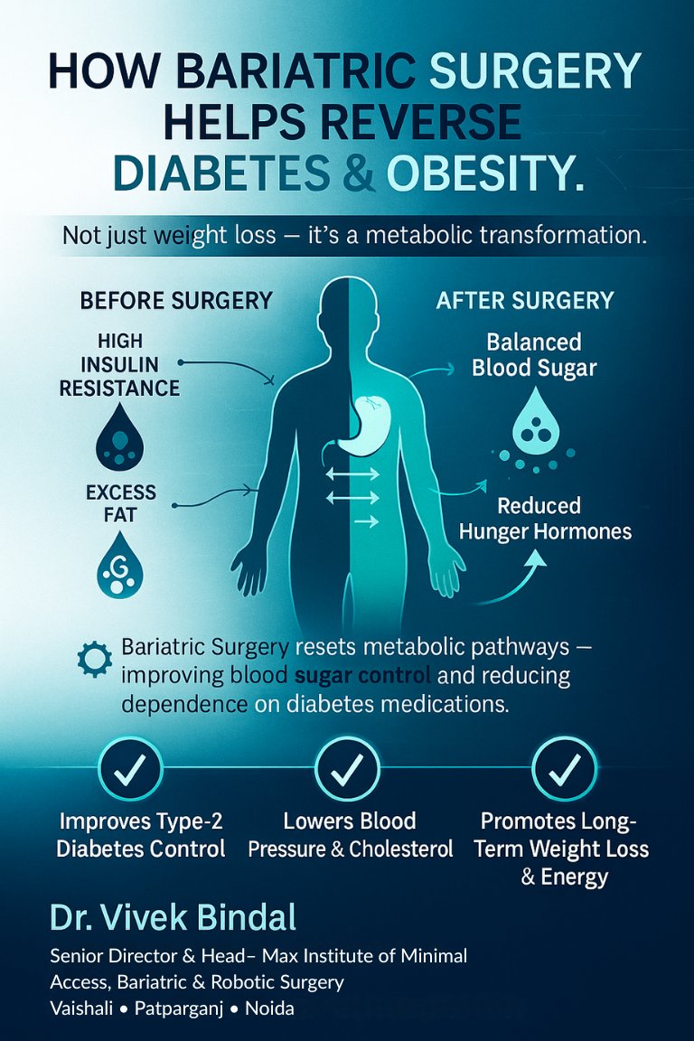 drvivekbindal's tweet image. Beyond Weight Loss — It’s a Metabolic Reset!
Bariatric Surgery isn’t just about losing kilos — it’s about gaining health.
#BariatricSurgery #MetabolicHealth #drvivekbindal #ObesityTreatment #DiabetesReversal #RoboticSurgery #weightlossjourney #HealthyLivingJourney #Maxhospital