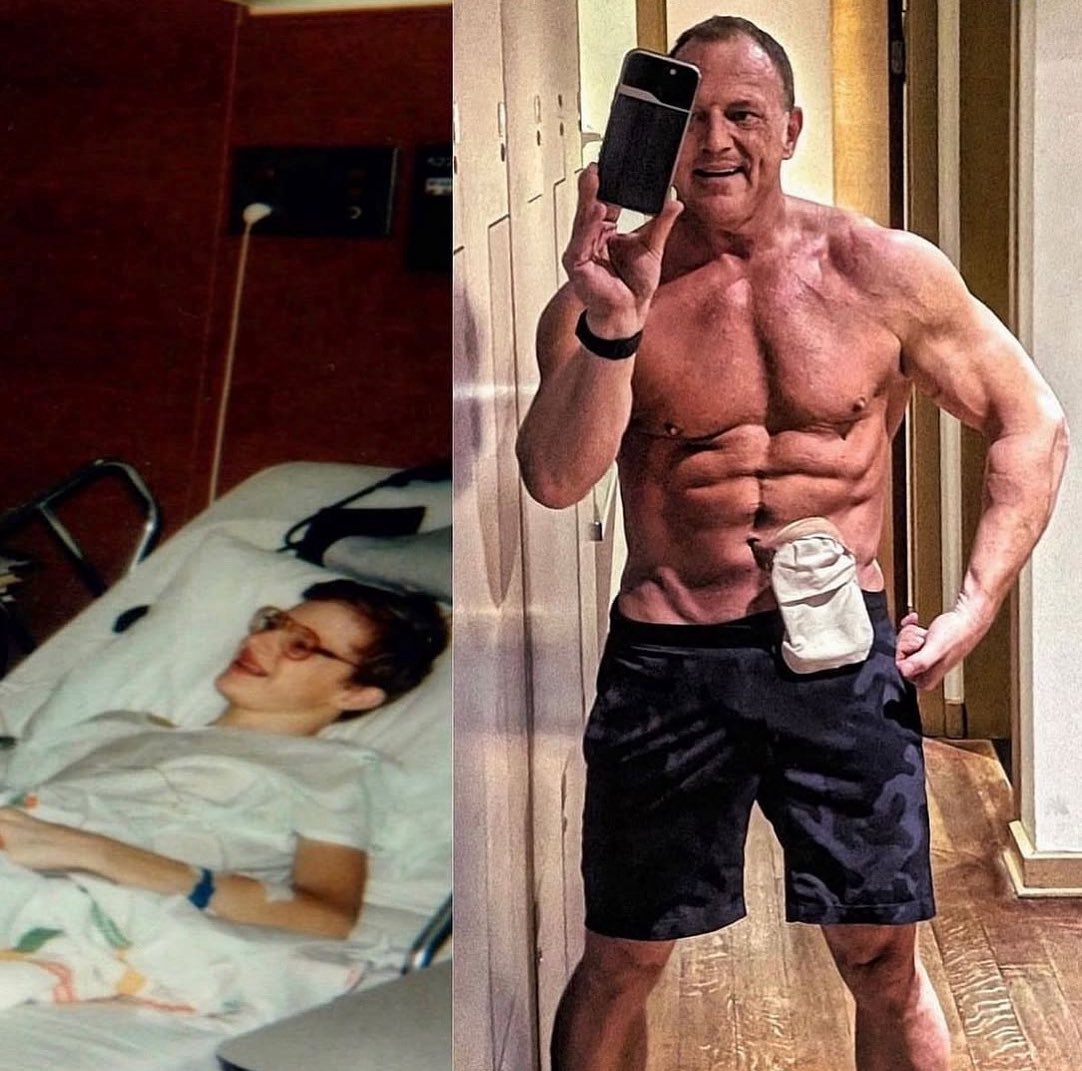 Happy #WorldOstomyDay! 💩🔥 
An ostomy isn’t an ending. It’s a second chance.

Thankful 🙏 for my ostomy... Without it I wouldn’t be alive to experience all the joy life has to offer!
💜 Share this to remind someone: survival and a full life &gt; stigma.
👇 Drop a 💪 if you believe