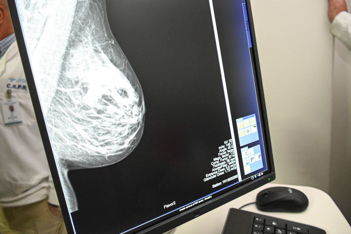 👩🏽 Durante octubre, ponemos a disposición mamógrafos en diversos puntos del país para que mujeres mayores de 40 años, usuarias de ASSE, sin síntomas y sin un estudio de tamizaje de cáncer de mama vigente, puedan realizarse la mamografía de forma gratuita, sin orden médica.