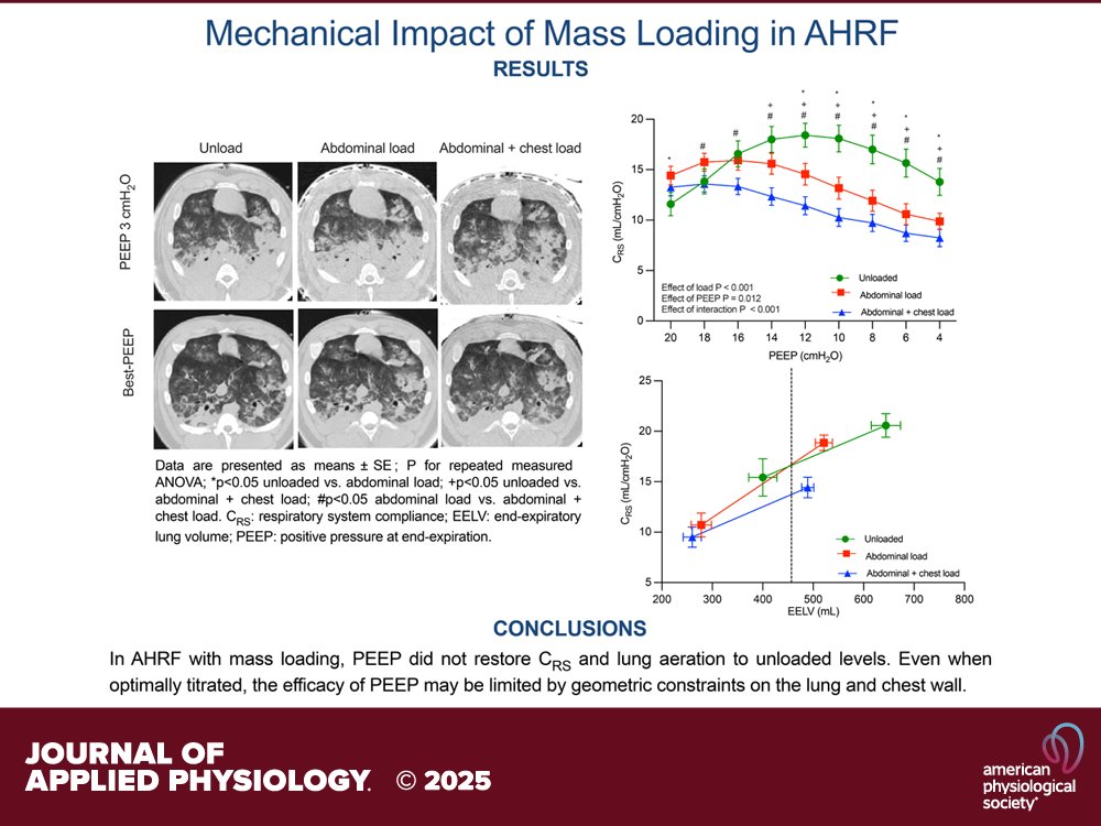 japplphysiol's tweet image. Research Article by A Nova et al. (@MassGeneral @UIowa @uvmvermont) #Biomechanical implications of #massloading in a swine model of acute #hypoxemic #respiratoryfailure
ow.ly/ZJsy50X0V0F