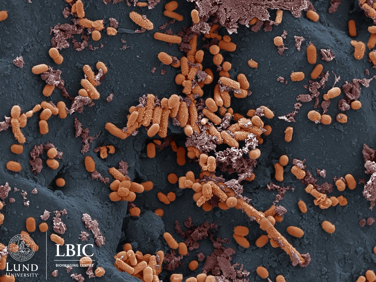 Water Research X tweet media