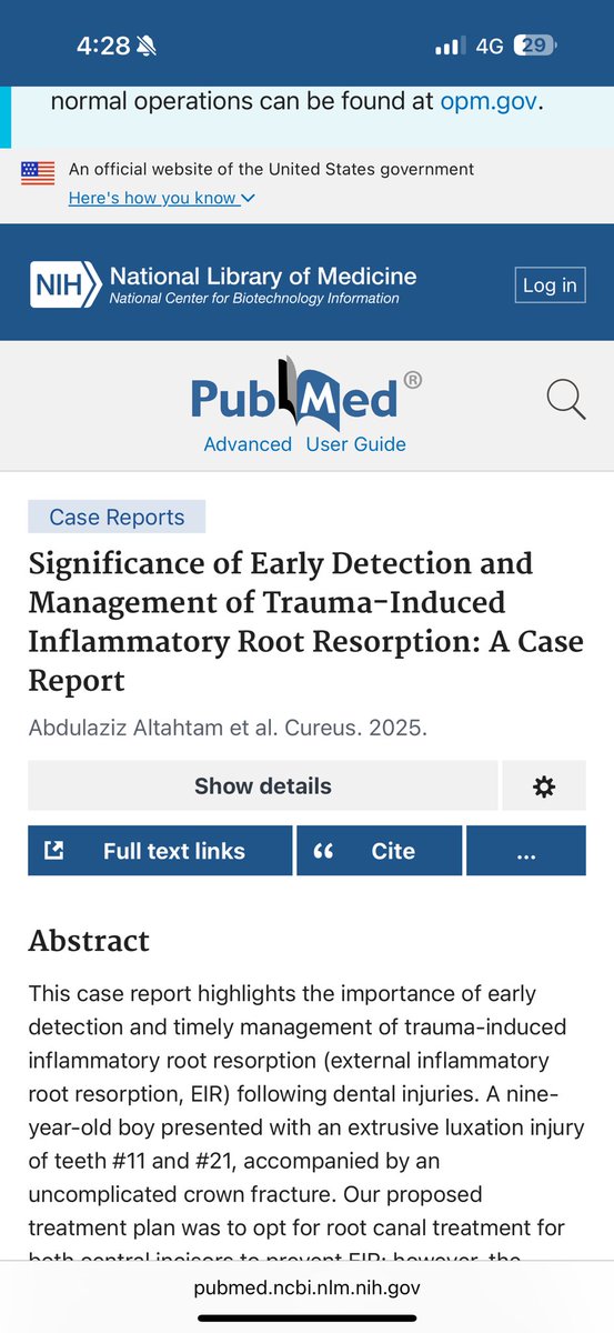 Happy to publish a new case report about traumatic induced root resorption ❤️