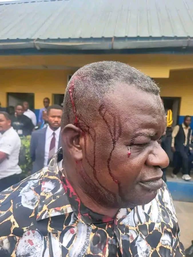 CongoVisuel's tweet photo. #KONGO_CENTRAL:
Tension à l’Assemblée provinciale .
L’honorable Billy Ntunga, député provincial élu de Madimba, a été blessé à la tête  lors d’une altercation violente survenue ce lundi à l’Assemblée provinciale du Kongo Central.
@IsralMutombo11 @Presidence_RDC @shabani_lukoo https://t.co/XV0Mtcv1xz