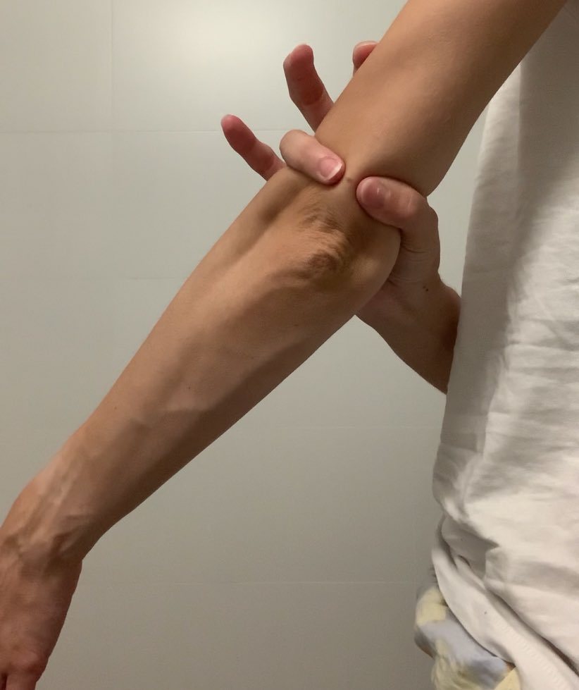 SO confused …
Left - right  =
now 39 kg, July 2024 ~38 kg, jan 2024 41kg 

Usually I can’t get my finger around my upper arm until I’m 36kg

I’m SO confused.