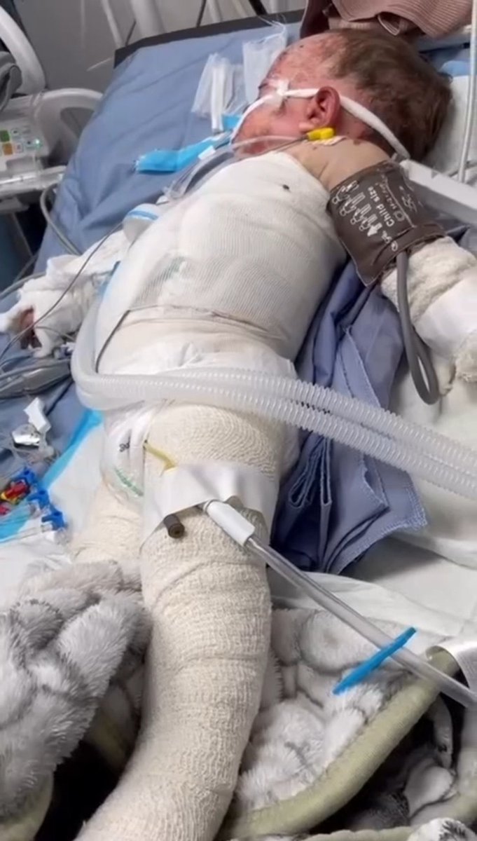 The only survivor of an Israeli attack that killed all of his family members. He is in the ICU alone..