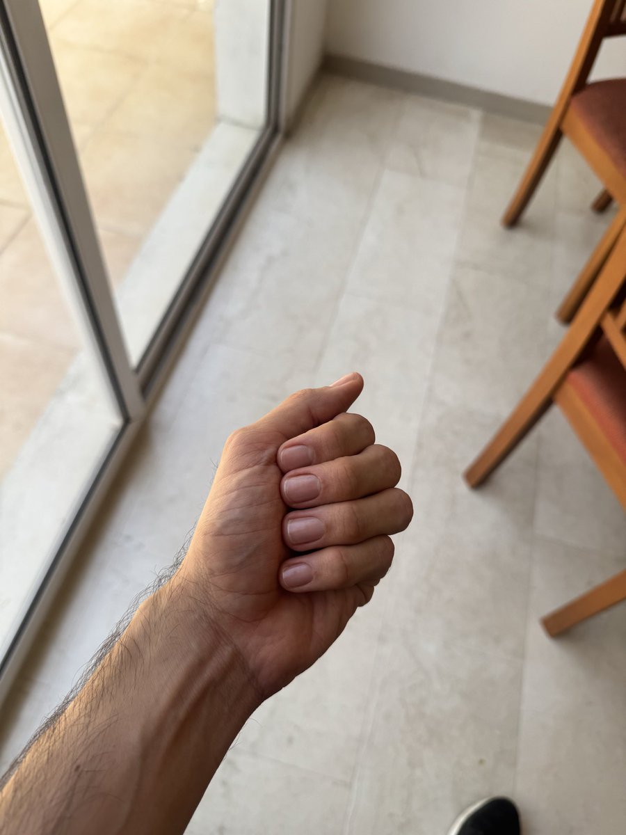 oscarantone's tweet image. 💅🏻