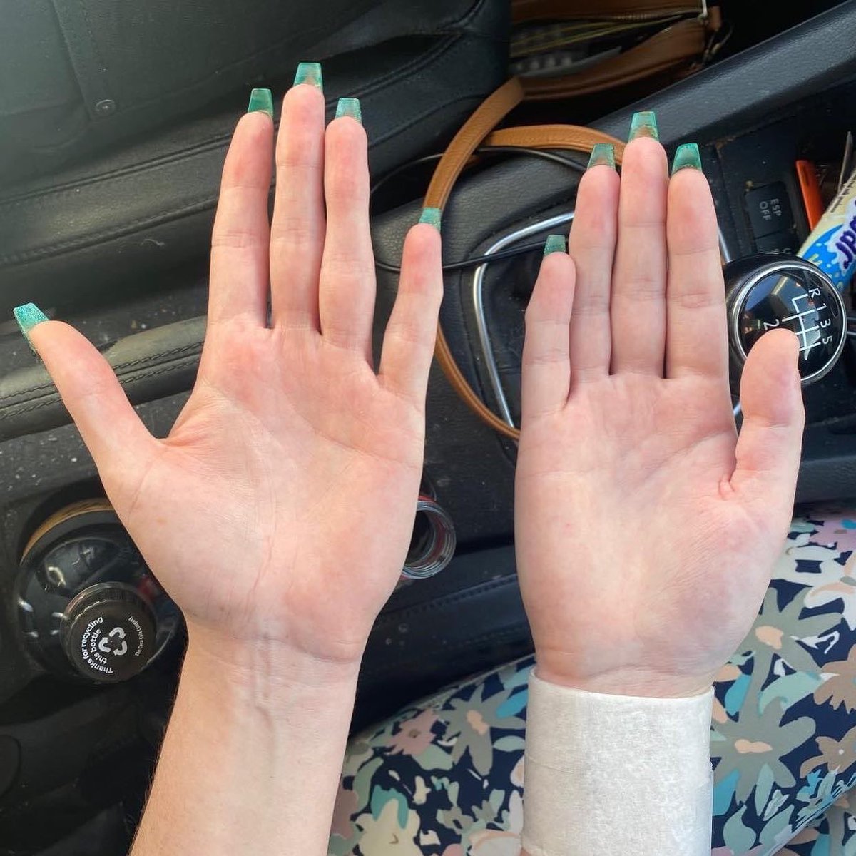 ChronicallyJen_'s tweet photo. The joys of CRPS……

It’s crazy to me to realise that for the last 5 years… I’ve been in a minimum of 6/10 pain every second of the day for 5 years 

I also deal with 5 other chronic illnesses….  I need a break 😭😔

Chronic illness breaks people 😔 https://t.co/fJ3VgtVRKJ