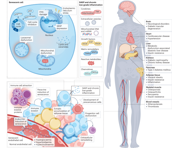 New content online: Translating cellular senescence research into clinical practice for metabolic disease bit.ly/48cmho5