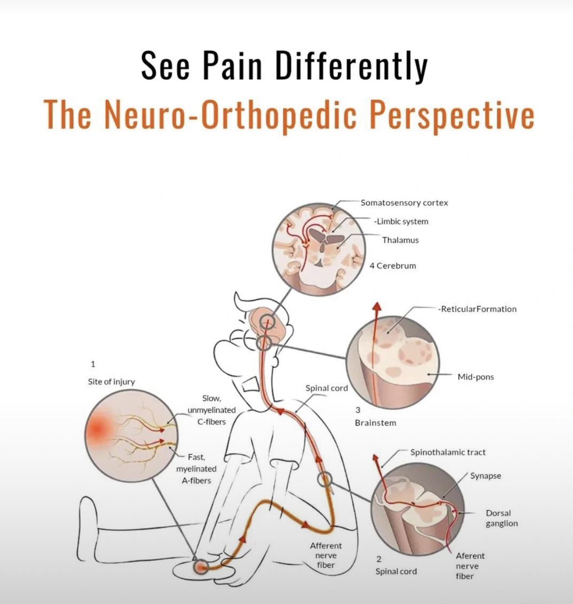Pain is not just a symptom.
It’s a neuro-biological process that travels from the site of injury to your spinal cord, brainstem, limbic system, and cortex. This neuro-orthopedic map helps clinicians treat pain at its roots, not just mask it.

#MaskUp #Communitycare #pain #viral