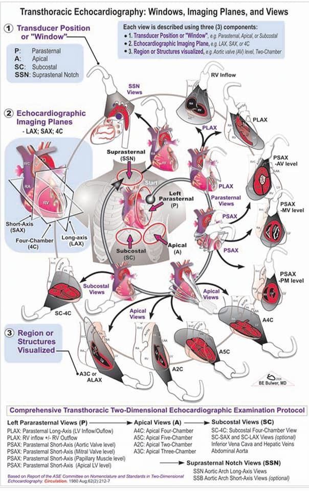 Dr sthanu subramanian (@drsthanus) on Twitter photo A diagram detailing the standard transthoracic echocardiography (TTE) examination protocol. It illustrates the different transducer positions (windows), imaging planes, and the resulting views of the heart.
<a href="/Ed_Alania/">Edgardo Alania</a> A diagram detailing the standard transthoracic echocardiography (TTE) examination protocol. It illustrates the different transducer positions (windows), imaging planes, and the resulting views of the heart.
<a href="/Ed_Alania/">Edgardo Alania</a>