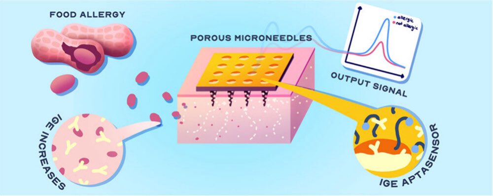 _Dr_Dana's tweet photo. What if a #microneedle patch could prevent life-threatening allergic reactions? 

In collaboration with the Salama Lab, we developed a microneedle-based aptasensor that can painlessly detect food #allergy sensitization, preventing analyphylaxis! 🥜 🏥 🔬

https://t.co/JXBm1zfVKA https://t.co/41d71vX7Zm