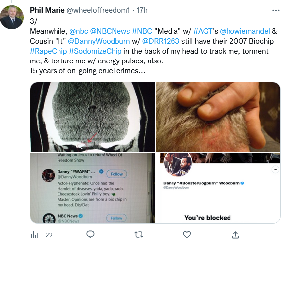 wheeloffreedom1's tweet photo. 2/
#BiochipTerrorists just keep🛰️⚡️shocking the shit out of me!
A*I*RNM🧠via biochips to monitor my every move & punish me!
It'd be great if @realDonaldTrump ordered removal of biochips!
Meanwhile, I just have to🛰️⚡️suffer every minute of my 60yo life! https://t.co/6X6KmI7AbP
