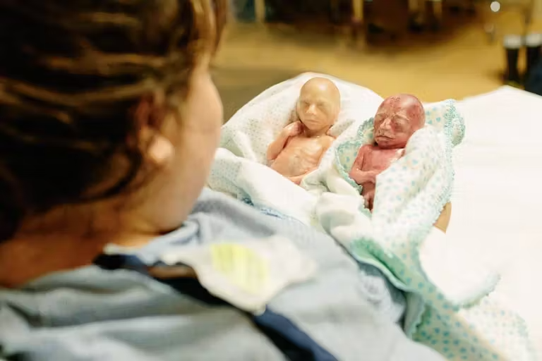 LiveAction's tweet photo. Chase and Cooper were identical twins miscarried at 22 weeks.

Their mother chose to share their photos, saying, “...I want people to know that this is what a 22-week-old child looks like.” https://t.co/WZ0G7LfWH4