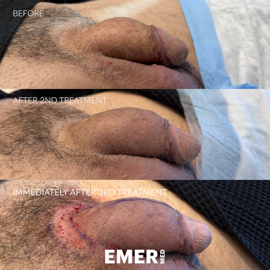 Dr. Jason Emer tweet media