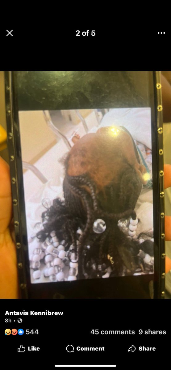 JustJenRX's tweet image. Please help this story go viral. 

6 year old autistic girl from Cleveland Ohio wanders off, gets beaten, strangled, SA’d by 3 boys ages 8-10 and the mayor of Cleveland has not returned the mother’s calls for help. 

They shoved sticks in her privates. Bit her. The level of…