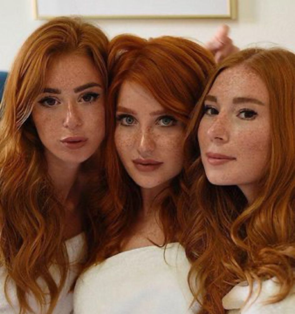 #FreckledFaced 🧡#Beauty