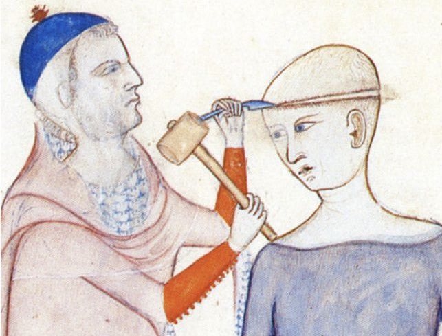 BielskiBoy's tweet photo. “Some people need a hole drilled in their skulls to make headaches stop and I think that’s okay” https://t.co/uCzSnQPQMc