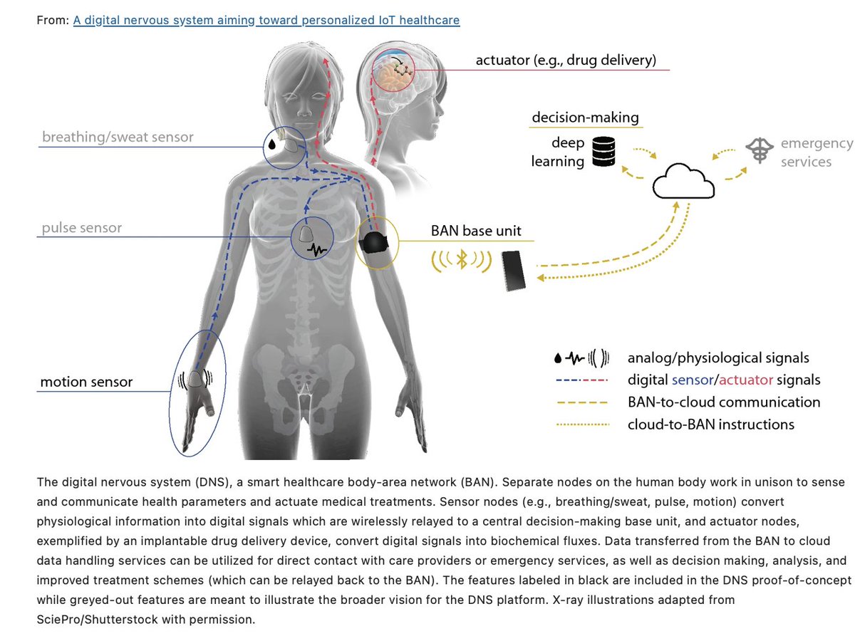 CorinneNokel's tweet image. A digital nervous system aiming toward personalized IoT healthcare

@IcicLaw 
@psinergy_SDW