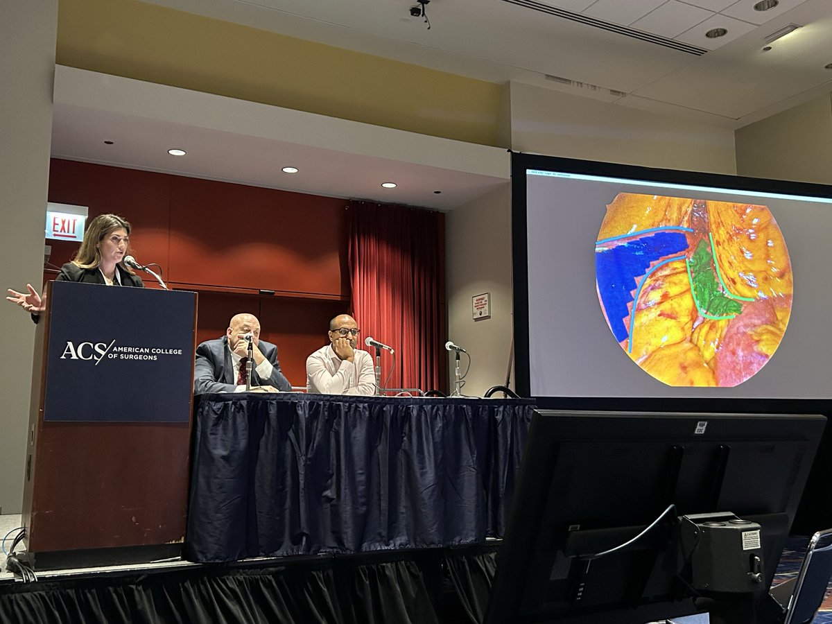 <a href="/JuliaSchroerMed/">Julia Schroer</a>, PGY-3, discussing management strategies for bile reflux seen in Billroth II reconstruction <a href="/scopdoc/">Patrick Reardon</a> <a href="/HMethodistMD/">Houston Methodist MD</a> #ACSCC25