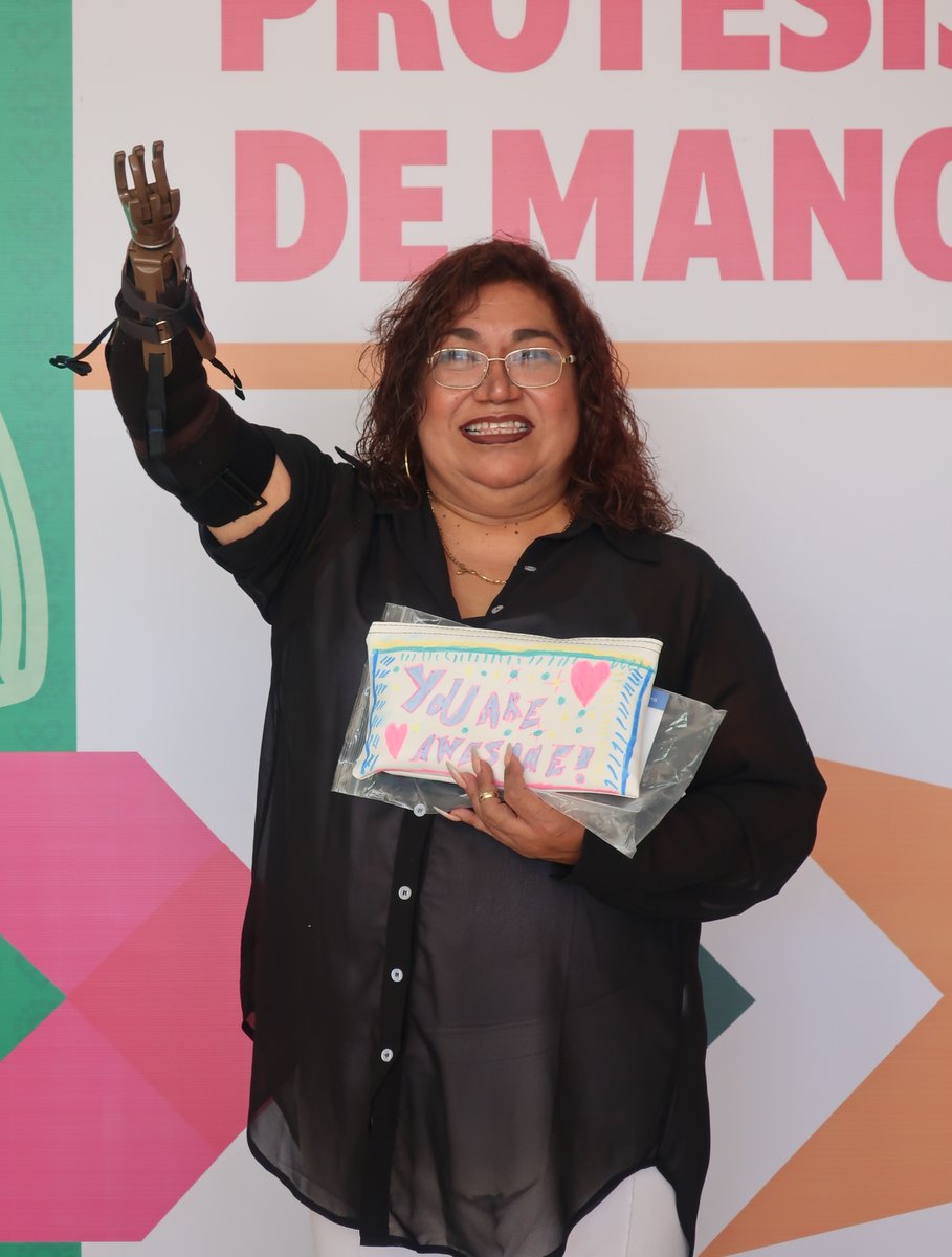 LN4HandProject's tweet image. MANY MANY THANKS to our Ambassadors (&amp;amp; their Rotaract Club) in Mexico for fitting 12 hands! This recipient is SO HAPPY 🥰🥰🥰