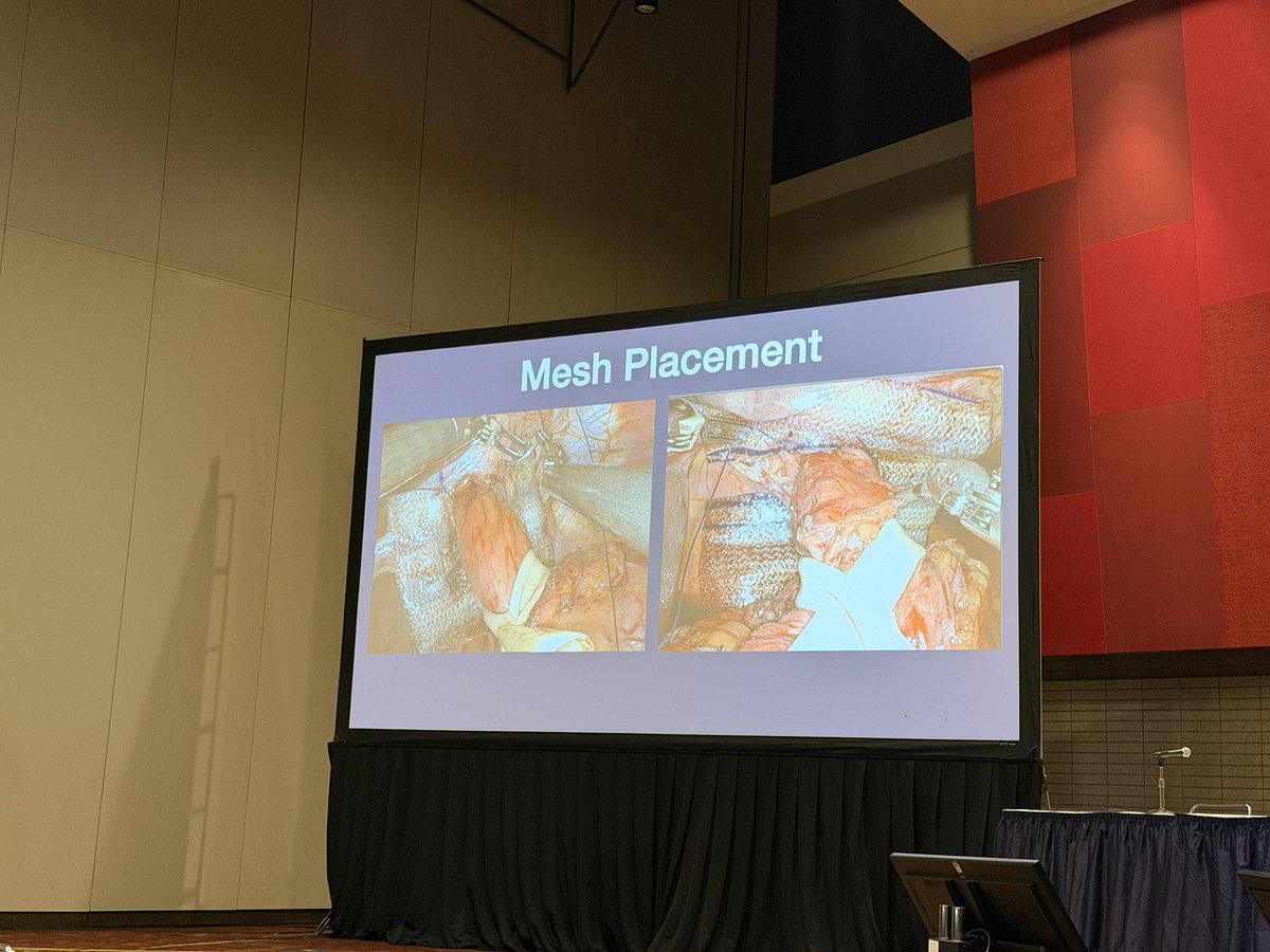 alisamae's tweet photo. Great foregut session on PEH repair @ #ACSCC2025. 

@houghton_dr gave a great talk on difficult cruroplasty. 

1. Use your tools (⬇️pneumo, mesh, relaxing incision…) 
2. Experience matters - should be done in high volume centers
3. Defect shape may predict success of closure https://t.co/gKETjeabq9