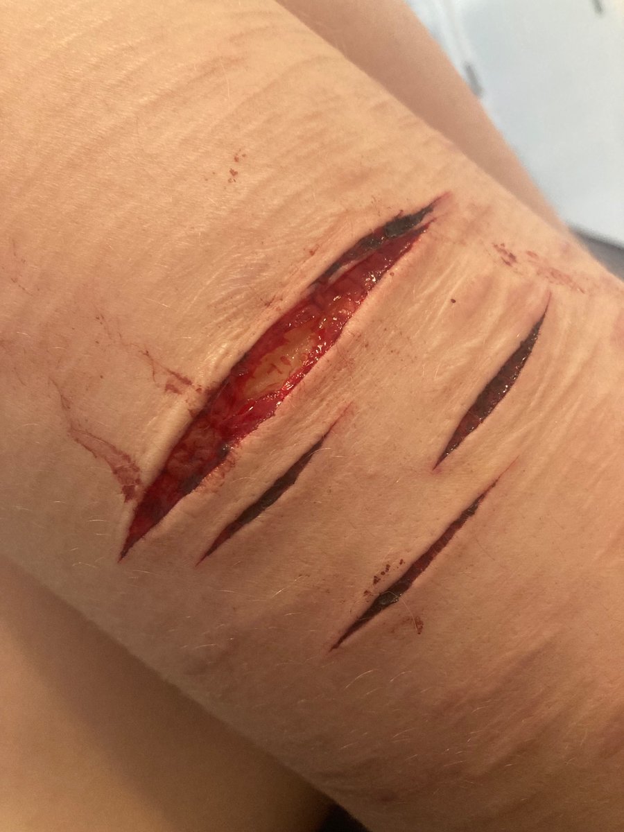 kimoineet's tweet photo. one swipe perfectly connected them i’m still not over this 
.
.
.
#shtwt #shedtwt #988twt #goretwt #beanstwt #heinztwt #redinktwt #styrotwt #slittwt #cuttwt #ouchietwt #owchietwt https://t.co/3O2NWNmaoD