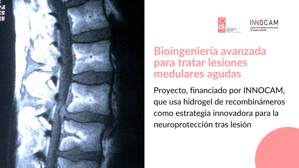 idiscam's tweet photo. 🧠 ¿Y si un hidrogel pudiera proteger la médula espinal tras una lesión?

Nuevo proyecto liderado por Francisco J. Rodríguez en el @HNParaplejicos
 
Financia #INNOCAM https://t.co/W7gIjsTRXG