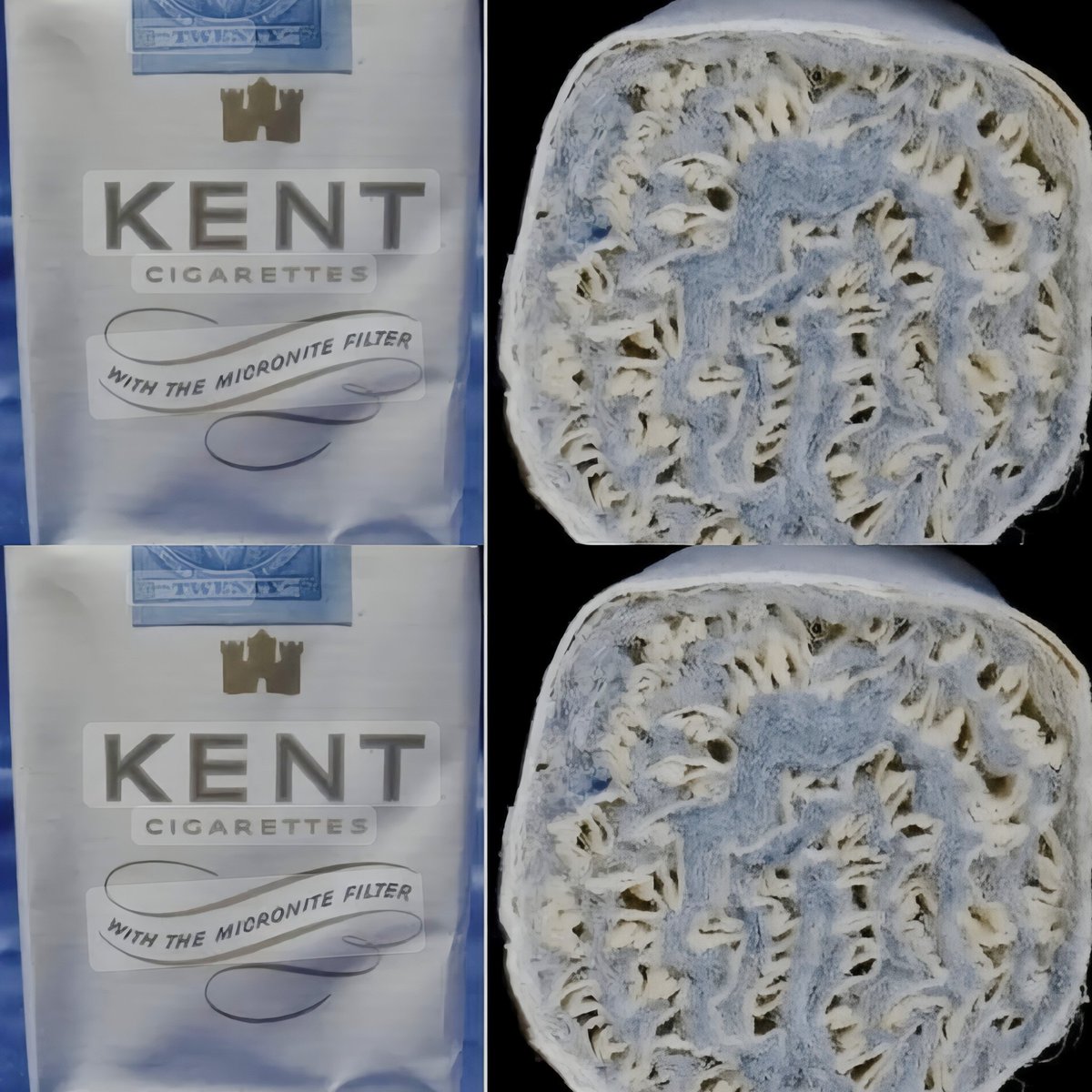 endodanli's tweet photo. Prometieron protección en cada bocanada, y todos creyeron. En 1952, entre noticias que ligaban el hábito de fumar con cáncer, Lorillard lanzó Kent con filtro Micronite, ofreciendo la mayor salud para los fieles al cigarrillo.

Quienes temían cambiaron de marca confiando en esa barrera. En 1956, la empresa pasó a filtro de acetato de celulosa tras dudas internas.

Años después, llegaron los mesoteliomas y juicios. La publicidad lo vendía como barrera contra el alquitrán. Lo que no sabían: el filtro llevaba crocidolita, un tipo de asbesto letal.

#KentMicronite #Tabaquismo #Asbesto #Crocidolita #DrIgnacioEndo