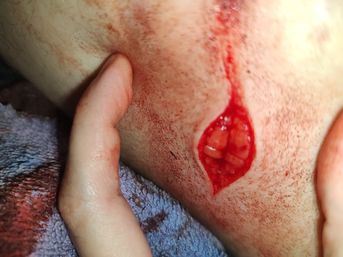 agoogogaga's tweet photo. I kind of am okay with the depth but I made it so small ugh #bloodtwt #redinktwt #styrotwt #raspberryfilling #ouchietwt #shtwt #sh #selfharm https://t.co/iNQdvmjQm0