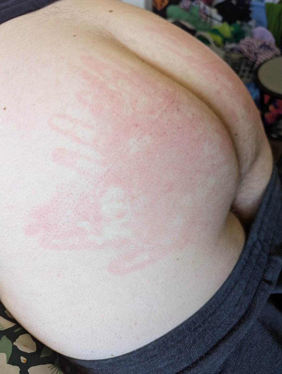 tasteofthekitty's tweet photo. Mus leave marks grr https://t.co/klFuHEvMLr