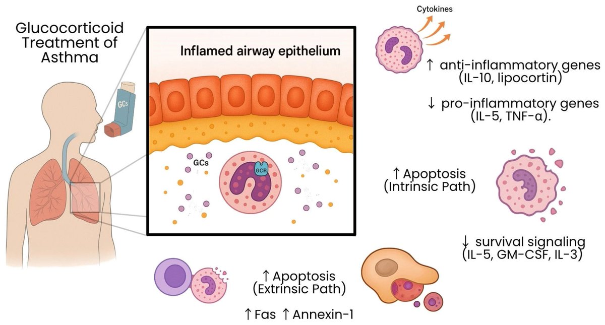 🔔#Allergies_MDPI Welcomes you to read our publication "Glucocorticoid-Mediated Modulation of Eosinopoiesis in Asthma: A Paradoxical Duality" by Dr. Bruno Vieira.

✅Link: brnw.ch/21wWpju

#AsthmaResearch #Immunology #Eosinophils #Glucocorticoids #Inflammation