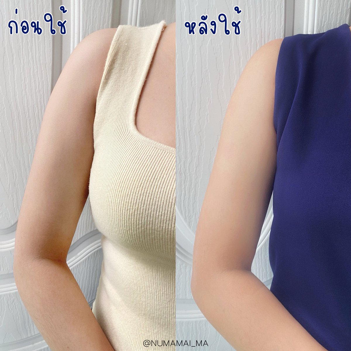 Huitong99721's tweet photo. #ไอเทมผิว ใช้คู่กันผิวใสมาก!✨ #นีเวียซูเปอร์10 สีชมพู สูตรใหม่ ตัวนี้ว่าผลัดจุดรอยดำเริ่ดแล้ว ยิ่งใช้คู่กับ NIVEA Skin glow serum รอยจางไว ผิวใสขึ้นกว่าเดิมมากก คือเลิ้บ! เค้าเป็นเนื้อเซรั่ม ทั้งคู่ใช้ด้วยกันก็ยังซึมไว ไม่เหนียว 100/10 เลยจ้าา 

#เคลียร์จุดดำดื้อโชว์ผิวใสเต็มสิบ https://t.co/UFij9yDhno