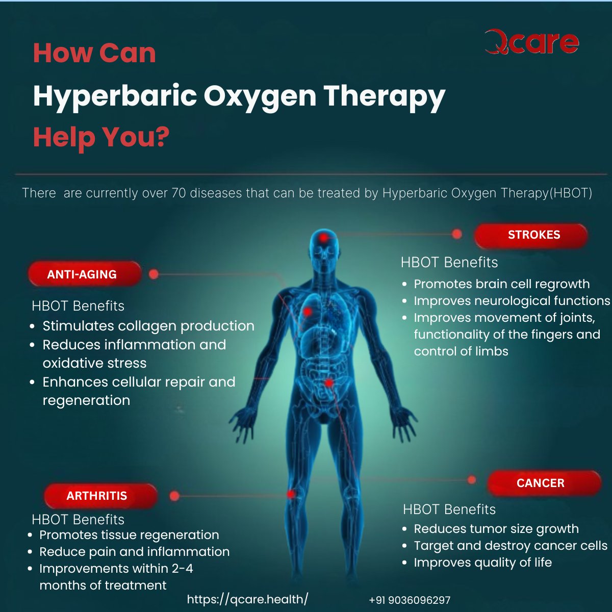 Qcare_Health's tweet photo. Unlock the healing power of oxygen. 💨https://t.co/SmSt0cjVLK | 📷 +91 9036096297  #OxygenTherapy #Qcare #AntiAging #StrokeRecovery #ArthritisRelief #CancerSupport #CellularHealing #AdvancedMedicine #WellnessTherapy https://t.co/gq1eRxkw6n