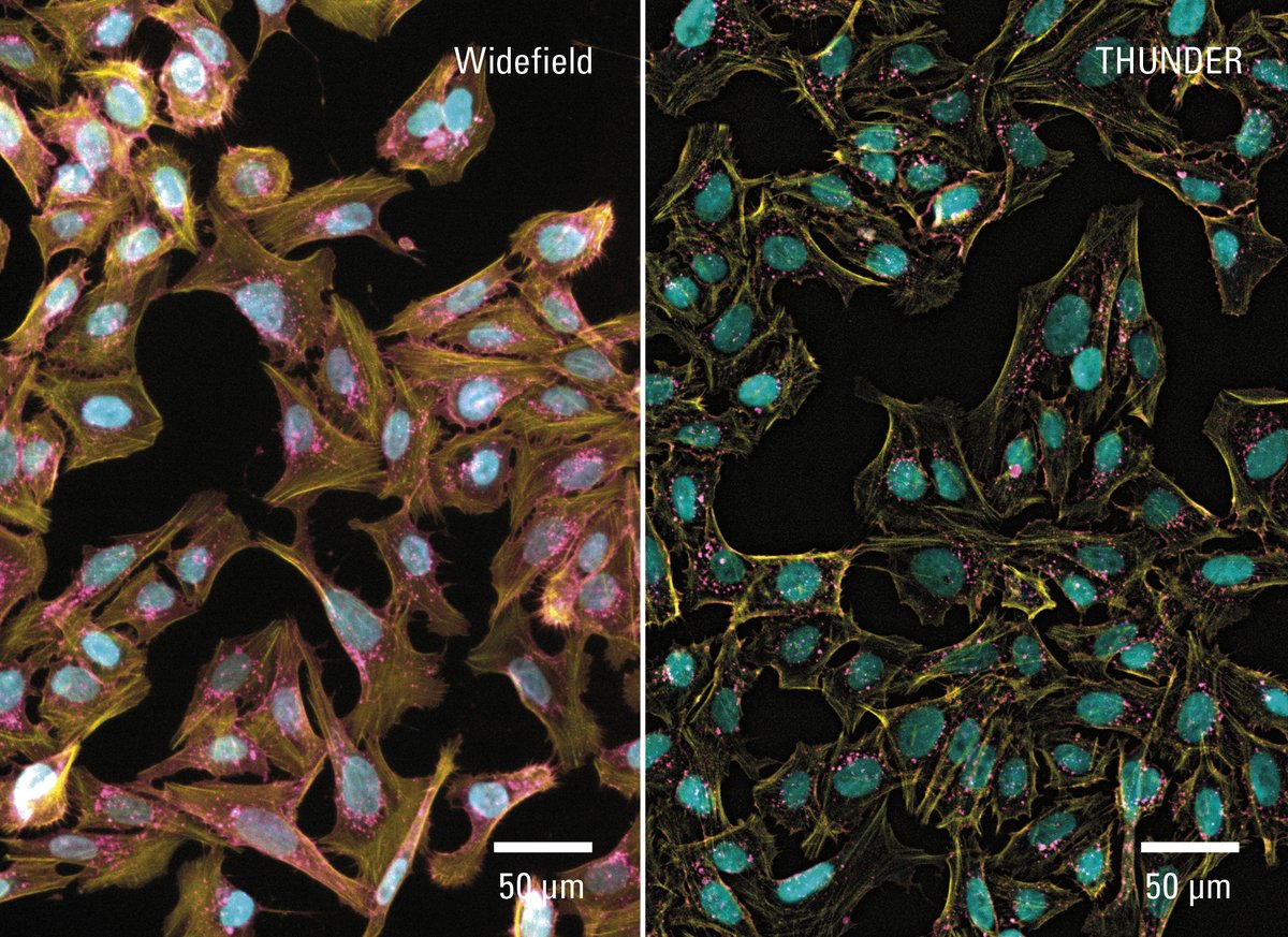 LeicaMicro's tweet image. Outer wells, inner clarity! This #2DCellCulture was imaged using standard plastic-bottom multi well plates with Mica’s optimized 20x Long Working Distance objective, which improves access to outer wells.

Learn more 👉 fcld.ly/cghirdg 

#Microscopy #MicroscopeObjective