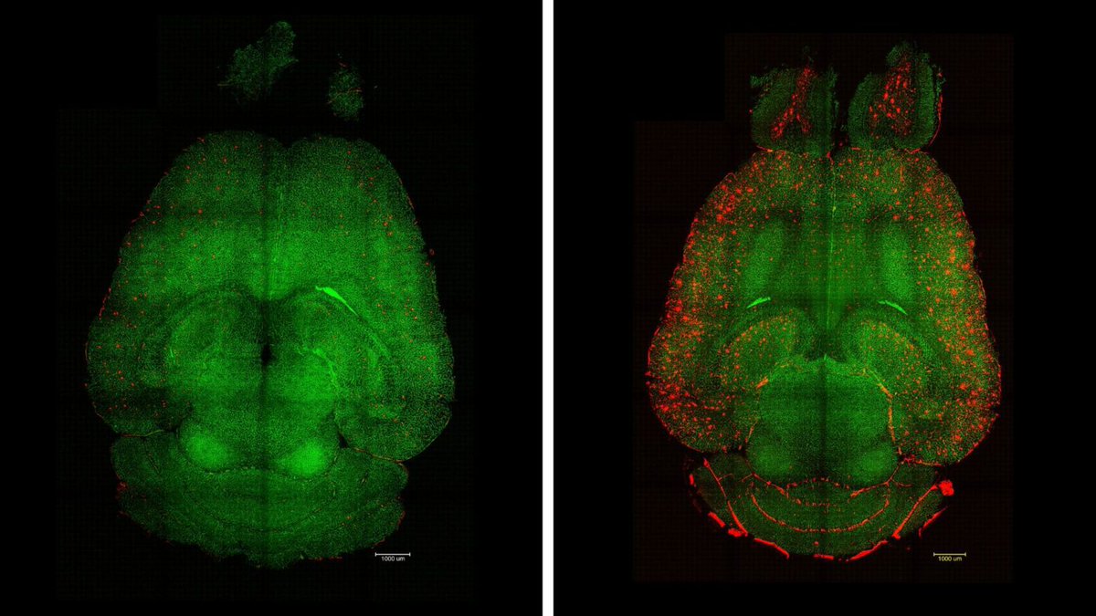 “The long-term effect comes from restoring the brain’s vasculature. What’s remarkable is that our nanoparticles act as a drug and seem to activate a feedback mechanism that brings this clearance pathway back to normal levels.” 🧠

- Giuseppe Battaglia

ibecbarcelona.eu