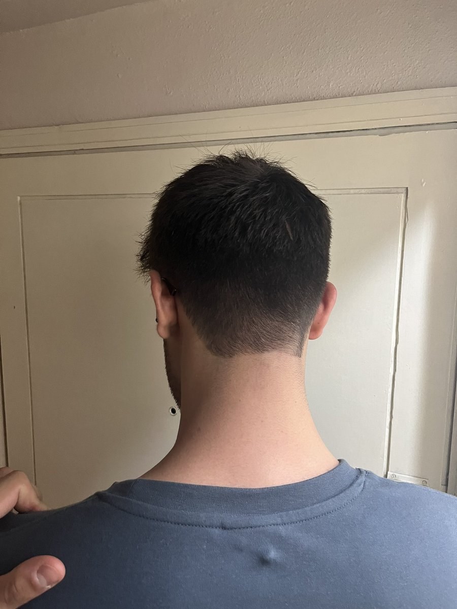 HAHAHAHA SENİN ELİNİ AYARINI SKİM MEHMET ABİ